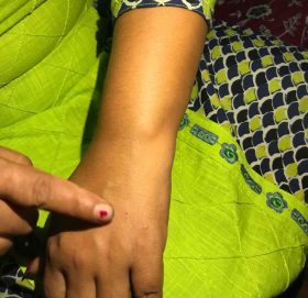 सिरिञ्ज आक्रमणः डेढ महिनामा नौ घाइते