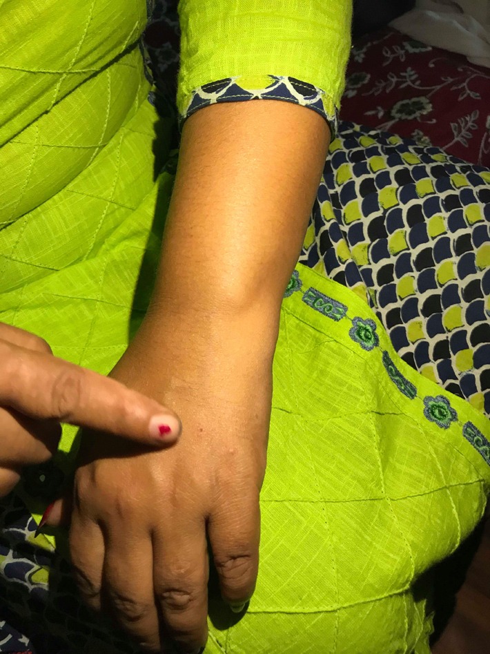 सिरिञ्ज आक्रमणः डेढ महिनामा नौ घाइते