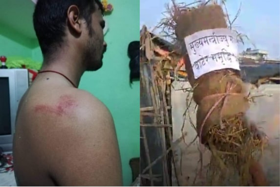मुख्यमन्त्रीको पूतला दहन गर्ने क्रममा साहलाई कुटपिट र दुई प्रहरीको नियन्त्रण पछि रिहा