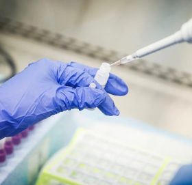 पीसीआर परीक्षण नगर्ने योजनामा सरकार, संक्रमणको दर अत्यधिक बढ्ने खतरा