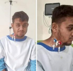 मृगौला पिडित गजुरेलको उपचारका लागि आर्थिक सहयोग गरिदिन परिवारको अपील