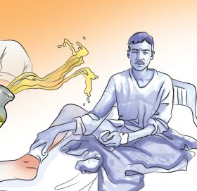 बाबुले आफ्नै छोराछोरीमाथि छ्यापे एसिड