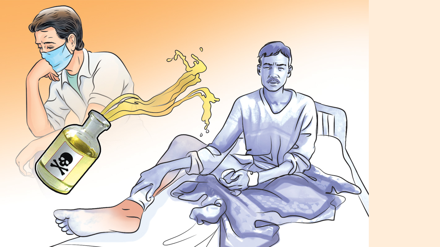 बाबुले आफ्नै छोराछोरीमाथि छ्यापे एसिड