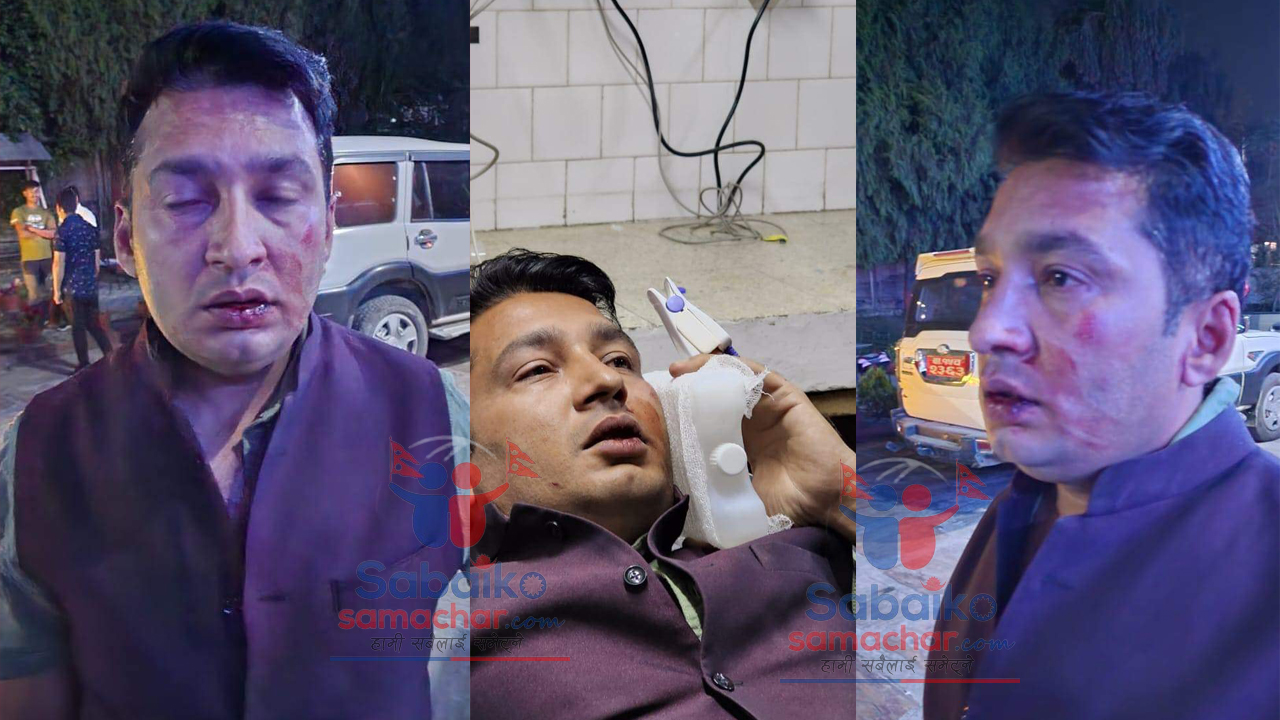 काभ्रेमा काँग्रेसका नगर सभापति लामाले कुटे काँग्रेसकै नेता (भिडियो )